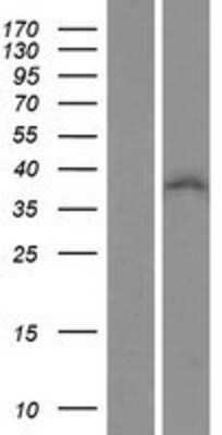 Western Blot: ZNF32 Overexpression Lysate (Adult Normal) [NBP2-07550] Left-Empty vector transfected control cell lysate (HEK293 cell lysate); Right -Over-expression Lysate for ZNF32.