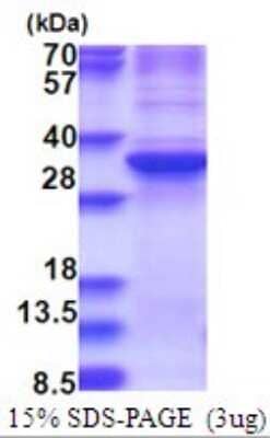 SDS-Page: ZNF32 Recombinant Protein [NBP2-51720] - 15% SDS Page (3 ug)