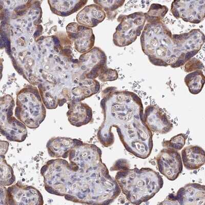 Immunohistochemistry-Paraffin: ZNF320 Antibody [NBP1-84114] - Staining of human placenta shows moderate cytoplasmic positivity in trophoblastic cells.