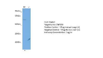Western Blot: ZNF320 Antibody [NBP2-86473] - Host: Rabbit. Target: ZNF320. Positive control (+): Human Lung (LU). Negative control (-): Human Liver (LI). Antibody concentration: 1ug/ml