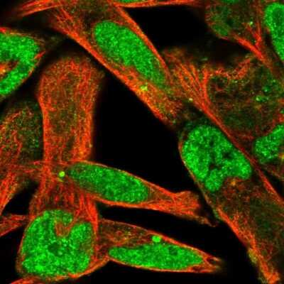Immunocytochemistry/Immunofluorescence: ZNF322A Antibody [NBP2-32047] - Staining of human cell line RH-30 shows localization to nucleoplasm, cytosol & centrosome.