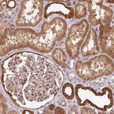 Immunohistochemistry: ZNF322A Antibody [NBP2-32047] - Staining of human kidney shows distinct cytoplasmic positivity in cells in tubules.
