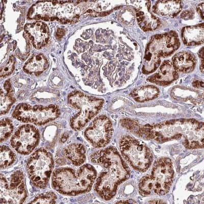 Immunohistochemistry: ZNF322A Antibody [NBP2-33384] - Staining of human kidney shows strong cytoplasmic positivity in cells in tubules.