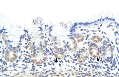 Immunohistochemistry-Paraffin: ZNF322A Antibody [NBP1-80365] - Human Stomach Tissue, Epithelial cells of funic gland (Indicated with Arrows) 4-8ug/ml.