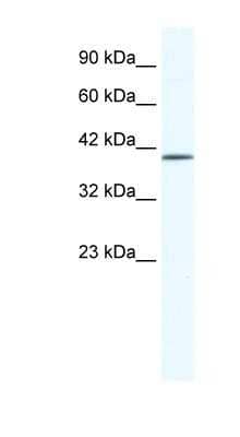 Western Blot: ZNF322A Antibody [NBP1-80123] - Jurkat cell lysate, concentration 0.2-1 ug/ml.