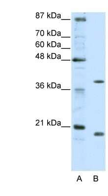 Western Blot: ZNF322A Antibody [NBP1-80365] - Titration: 0.2-1 ug/ml, Positive Control: HepG2 cell lysate.