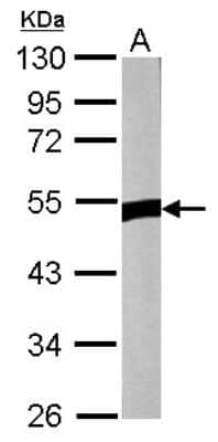 Western Blot: ZNF322A Antibody [NBP2-20990] - Sample (50 ug of whole cell lysate) A: Rat muscle, 10% SDS PAGE gel, diluted at 1:1000.