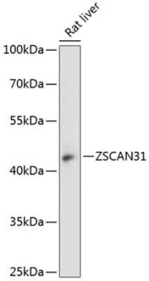 Western Blot: ZNF323 Antibody [NBP2-93208] - Analysis of extracts of rat liver, using ZNF323 at 1:3000 dilution.Secondary antibody: HRP Goat Anti-Rabbit IgG (H+L) at 1:10000 dilution.Lysates/proteins: 25ug per lane.Blocking buffer: 3% nonfat dry milk in TBST.Detection: ECL Basic Kit .Exposure time: 90s.