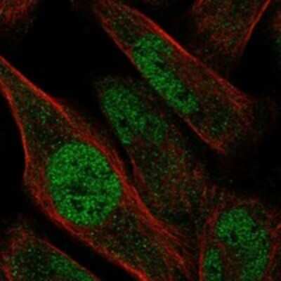 Immunocytochemistry/Immunofluorescence: ZNF329 Antibody [NBP3-17782] - Staining of human cell line RH-30 shows localization to nucleoplasm.