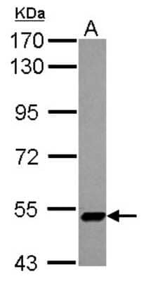 Western Blot: ZNF329 Antibody [NBP2-20993] - Sample (30 ug of whole cell lysate) A: NT2D1 7. 5% SDS PAGE gel, diluted at 1:1000.