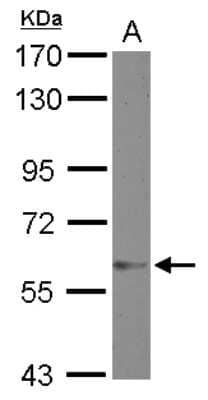 Western Blot: ZNF329 Antibody [NBP2-20994] - Sample (30 ug of whole cell lysate) A: MCF-7 7. 5% SDS PAGE gel, diluted at 1:2000.