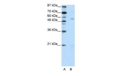 Western Blot: ZNF329 Antibody [NBP2-88668] - WB Suggested Anti-ZNF329 Antibody Titration: 2.5ug/ml. ELISA Titer: 1:312500. Positive Control: HepG2 cell lysate