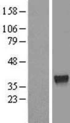 Western Blot ZNF330 Overexpression Lysate