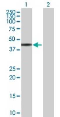 Western Blot ZNF331 Antibody - Azide and BSA Free