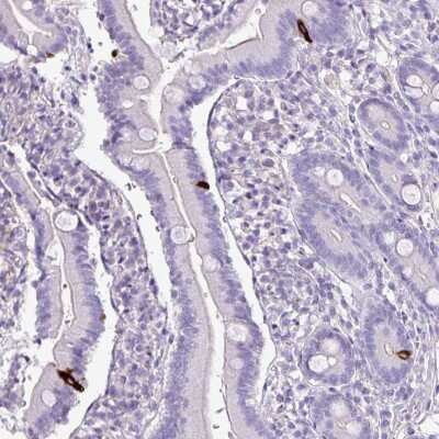 Immunohistochemistry-Paraffin ZNF334 Antibody - BSA Free