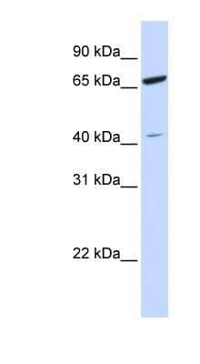Western Blot: ZNF334 Antibody [NBP1-79707] - Hela cell lysate, concentration 0.2-1 ug/ml.