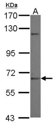 Western Blot ZNF334 Antibody