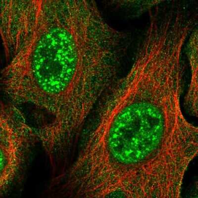 Immunocytochemistry/ Immunofluorescence ZNF337 Antibody - BSA Free