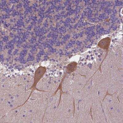 Immunohistochemistry-Paraffin ZNF337 Antibody - BSA Free