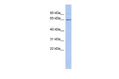 Western Blot: ZNF337 Antibody [NBP2-86477] - WB Suggested Anti-ZNF337 Antibody Titration: 0.2-1 ug/ml. ELISA Titer: 1:312500. Positive Control: PANC1 cell lysate