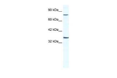 Western Blot: ZNF337 Antibody [NBP2-86478] - WB Suggested Anti-ZNF337 Antibody Titration: 2.5ug/ml. ELISA Titer: 1:1562500. Positive Control: Jurkat cell lysateZNF337 is supported by BioGPS gene expression data to be expressed in Jurkat
