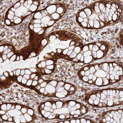 Immunohistochemistry-Paraffin: ZNF342 Antibody [NBP2-13565] - Staining of human rectum shows strong cytoplasmic positivity in glandular cells.