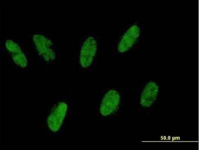 Immunocytochemistry/ Immunofluorescence ZNF343 Antibody