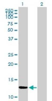 Western Blot ZNF343 Antibody