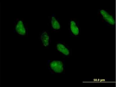 Immunocytochemistry/Immunofluorescence: ZNF346 Antibody [H00023567-B01P] - Analysis of purified antibody to ZNF346 on HeLa cell. (antibody concentration 10 ug/ml)