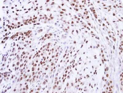Immunohistochemistry-Paraffin ZNF346 Antibody - BSA Free