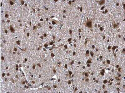 Immunohistochemistry-Paraffin ZNF346 Antibody - BSA Free