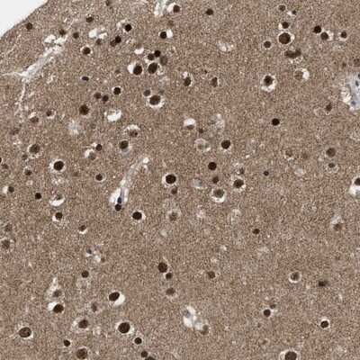 Immunohistochemistry-Paraffin: ZNF346 Antibody [NBP1-83084] - Staining of human cerebral cortex shows strong nuclear positivity in neuronal cells and glial cells.