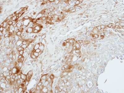 Immunohistochemistry-Paraffin: ZNF346 Antibody [NBP2-20997] - H358 xenograft, using ZNF346 antibody at 1:100 dilution. Antigen Retrieval: Citrate buffer, pH 6.0, 15 min. 