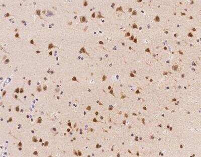 Immunohistochemistry-Paraffin ZNF346 Antibody - BSA Free