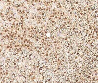 Immunohistochemistry-Paraffin ZNF346 Antibody - BSA Free