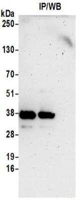 <b>Biological Strategies Validation. </b>Immunoprecipitation: ZNF346 Antibody [NBP2-32230] - Samples:  Whole cell lysate (0.5 or 1.0 mg per IP reaction; 20% of IP loaded) from 293T cells. Antibodies:  Affinity purified rabbit anti-ZNF346 antibody NBP2-32230 used for IP at 6 ug per reaction. ZNF346 was also immunoprecipitated by rabbit anti-ZNF346 antibody BL14332.  For blotting immunoprecipitated ZNF346, NBP2-32230 was used at 1 ug/ml.  Detection: Chemiluminescence with an exposure time of 3 minutes.