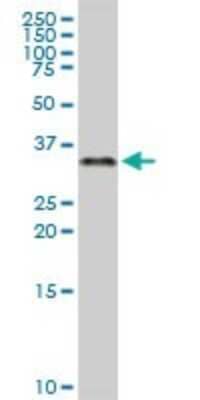 Western Blot: ZNF346 Antibody [H00023567-D01P] - Analysis of ZNF346 expression in human pancreas.