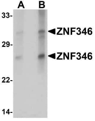 Western Blot ZNF346 Antibody - BSA Free