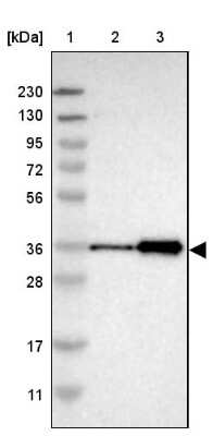 Western Blot: ZNF346 Antibody [NBP1-83084] - Lane 1: Marker  [kDa] 230, 130, 95, 72, 56, 36, 28, 17, 11.  Lane 2: Human cell line RT-4.  Lane 3: Human cell line U-251MG sp
