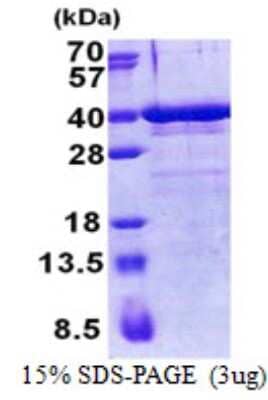 SDS-PAGE Recombinant Human ZNF346 His Protein