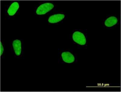 Immunocytochemistry/Immunofluorescence: ZNF35 Antibody (2B4) [H00007584-M03] - Analysis of monoclonal antibody to ZNF35 on HeLa cell. Antibody concentration 10 ug/ml