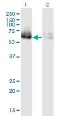 Western Blot: ZNF35 Antibody (2B4) [H00007584-M03] - Analysis of ZNF35 expression in transfected 293T cell line by ZNF35 monoclonal antibody (M03), clone 2B4. Lane 1: ZNF35 transfected lysatE (58.2 KDa). Lane 2: Non-transfected lysate.