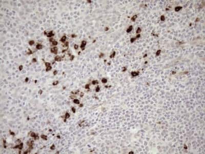 Immunohistochemistry: ZNF35 Antibody (4D5) [NBP2-46434] - Analysis of Human tonsil tissue. (Heat-induced epitope retrieval by 1mM EDTA in 10mM Tris buffer (pH8.5) at 120C for 3 min)