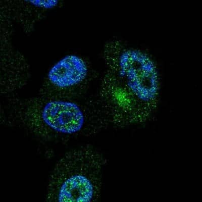 Immunocytochemistry/Immunofluorescence: ZNF35 Antibody [NBP2-30842] - Immunofluorescent staining of human cell line PC-3 shows localization to nucleoplasm & cytosol.