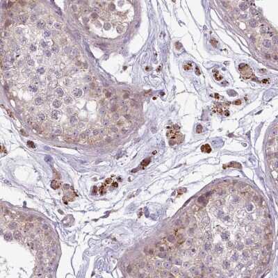 Immunohistochemistry-Paraffin: ZNF35 Antibody [NBP2-30820] - Staining of human testis shows cytoplasmic positivity in cells in seminiferous ducts and Leydig cells.