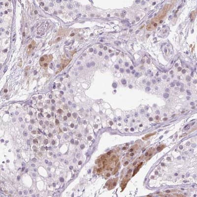 Immunohistochemistry-Paraffin: ZNF35 Antibody [NBP2-30842] - Staining of human testis shows nuclear and cytoplasmic positivity in cells in seminiferous ducts and Leydig cells.