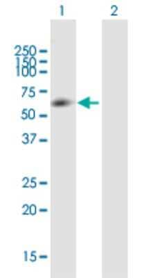 Western Blot: ZNF35 Antibody [H00007584-B01P] - Analysis of ZNF35 expression in transfected 293T cell line by ZNF35 polyclonal antibody.  Lane 1: ZNF35 transfected lysate(57.2 KDa). Lane 2: Non-transfected lysate.