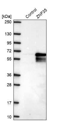 Western Blot: ZNF35 Antibody [NBP2-30820] - Analysis in control (vector only transfected HEK293T lysate) and ZNF35 over-expression lysate (Co-expressed with a C-terminal myc-DDK tag (3.1 kDa) in mammalian HEK293T cells).