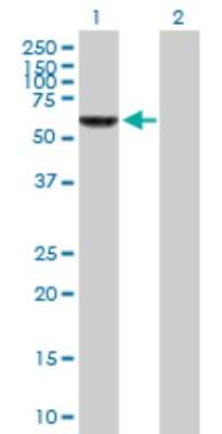 Western Blot: ZNF350 Antibody [H00059348-B01P] - Analysis of ZNF350 expression in transfected 293T cell line by ZNF350 polyclonal antibody.  Lane 1: ZNF350 transfected lysate(58.52 KDa). Lane 2: Non-transfected lysate.