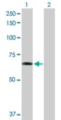 Western Blot: ZNF350 Antibody [H00059348-D01P] - Analysis of ZNF350 expression in transfected 293T cell line by ZNF350 polyclonal antibody.Lane 1: ZNF350 transfected lysate(60.00 KDa).Lane 2: Non-transfected lysate.